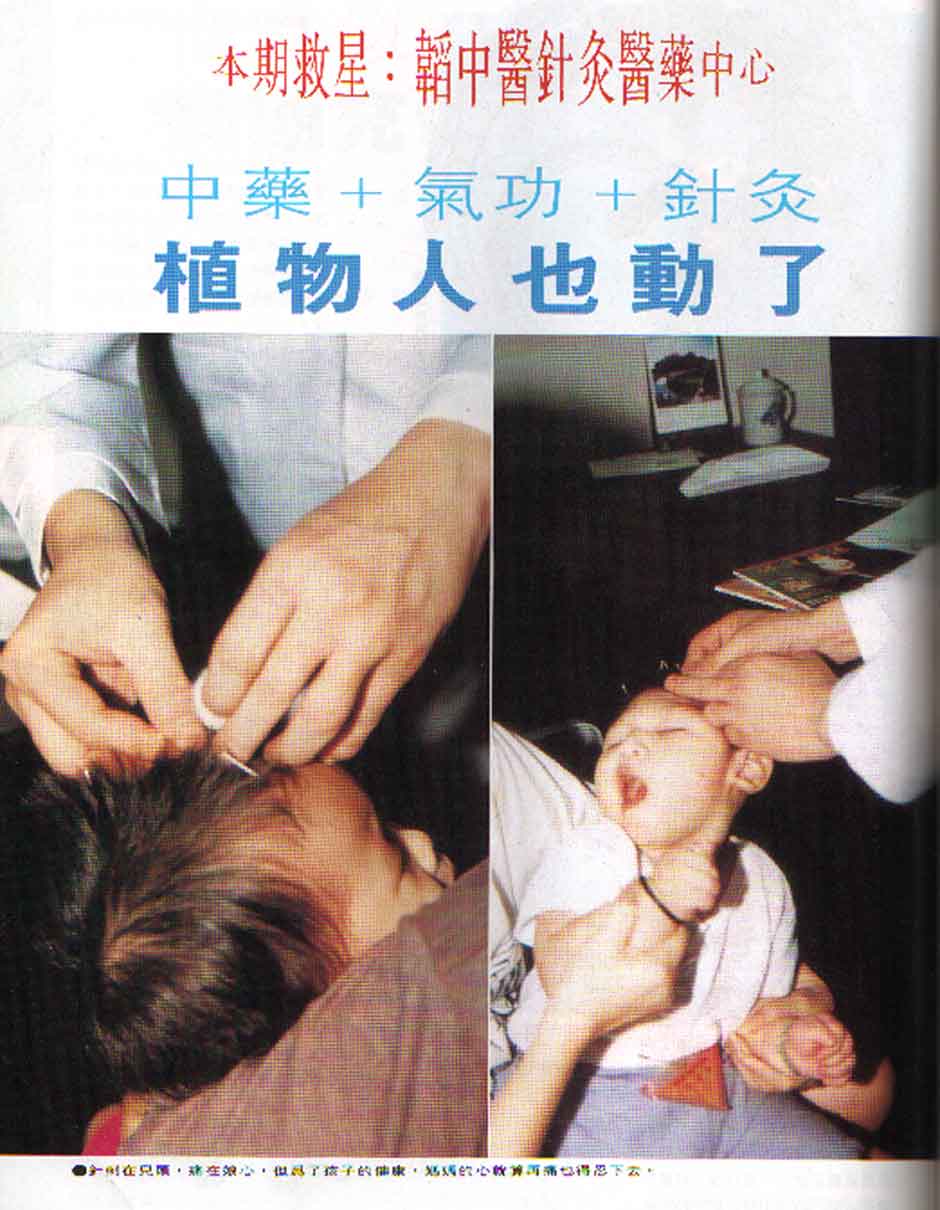 beta thalassemia treatment