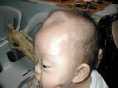 Malaysia Cerebral Palsy Cure Treatment Acupuncture Herbal Medicine Treatment Cure Centre