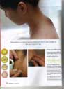 Acupuncture Herbal Magazine Health News of The Tole Acupuncture Herbal Treatment Cure